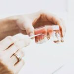 Dental Implants and Dentures